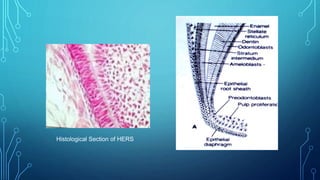 Histological Section of HERS
 