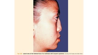 Development of skull embryology copy.pptx