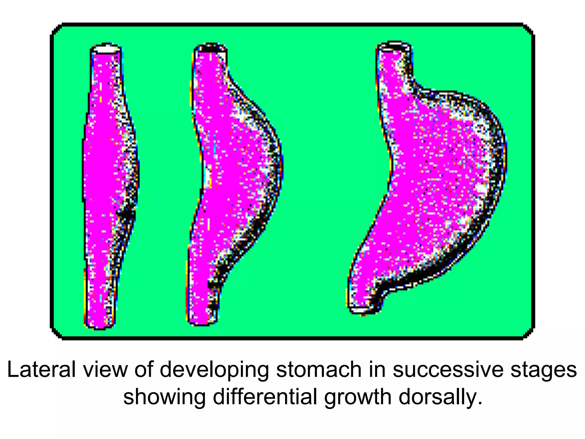 Lateral view of developing stomach in successive stages
showing differential growth dorsally.
 