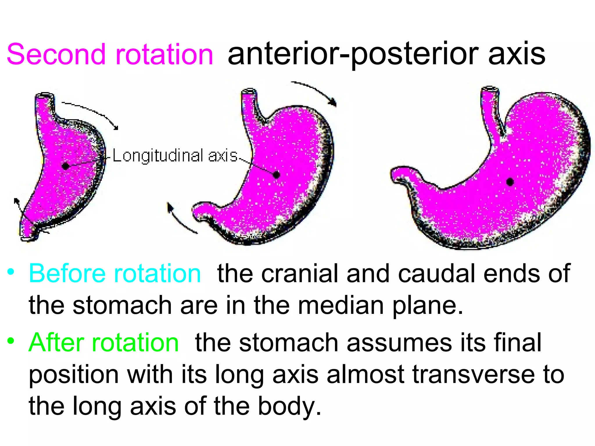 Second rotation anterior-posterior axis
• Before rotation, the cranial and caudal ends of
the stomach are in the median plane.
• After rotation, the stomach assumes its final
position with its long axis almost transverse to
the long axis of the body.
 