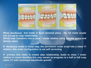 When deciduous 2nd molar in flush terminal plane , the 1st molar erupts
into a cusp to cusp relationship,
Which later transform into a class 1 molar relation using primate space and
leeway space

If deciduous molar in distal step, the permanent molar erupt into a class 11
relation, this molar configuration is not self correcting

If primary 2nd molar in mesial step relationship, leads to class 1 molar
relation in mixed dentition this may remain or progress to a half or full cusp
class 111 with continued mandibular growth

  09/24/12
 