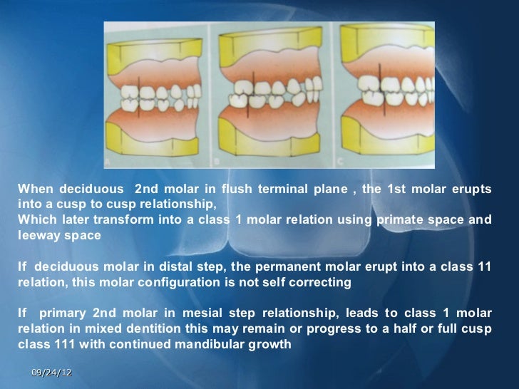 Development of teeth
