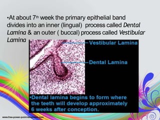 •At about 7th week the primary epithelial band
divides into an inner (lingual) process called Dental
Lamina & an outer ( buccal) process called Vestibular
Lamina
 
