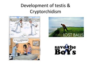 Development of testis &
Cryptorchidism
 
