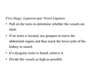 First Stage: Laparoscopic Vessel Ligation
• Pull on the testis to determine whether the vessels are
short
• If no testis is located, use graspers to move the
abdominal organs and thus reach the lower pole of the
kidney to search
• If a dysgenic testis is found, remove it.
• Divide the vessels as high as possible
 