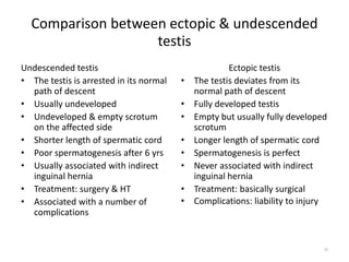 Comparison between ectopic & undescended
testis
Undescended testis
• The testis is arrested in its normal
path of descent
• Usually undeveloped
• Undeveloped & empty scrotum
on the affected side
• Shorter length of spermatic cord
• Poor spermatogenesis after 6 yrs
• Usually associated with indirect
inguinal hernia
• Treatment: surgery & HT
• Associated with a number of
complications
Ectopic testis
• The testis deviates from its
normal path of descent
• Fully developed testis
• Empty but usually fully developed
scrotum
• Longer length of spermatic cord
• Spermatogenesis is perfect
• Never associated with indirect
inguinal hernia
• Treatment: basically surgical
• Complications: liability to injury
26
 