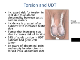 Torsion and UDT
• Increased risk for torsion in
UDT due to anatomic
abnormality between testis
and mesentery
• Incidence is greatest after
puberty with increased testis
size
• Tumor that increases size
also increases risk of torsion
• 64% of adult torsion in UDT
patients had germ cell
tumor
• Be aware of abdominal pain
and empty hemiscrotum=>
torsed intra-abdominal UDT
 