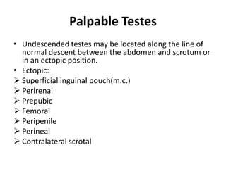 Palpable Testes
• Undescended testes may be located along the line of
normal descent between the abdomen and scrotum or
in an ectopic position.
• Ectopic:
 Superficial inguinal pouch(m.c.)
 Perirenal
 Prepubic
 Femoral
 Peripenile
 Perineal
 Contralateral scrotal
 