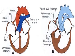 Development of the cardiovascular system.pptx