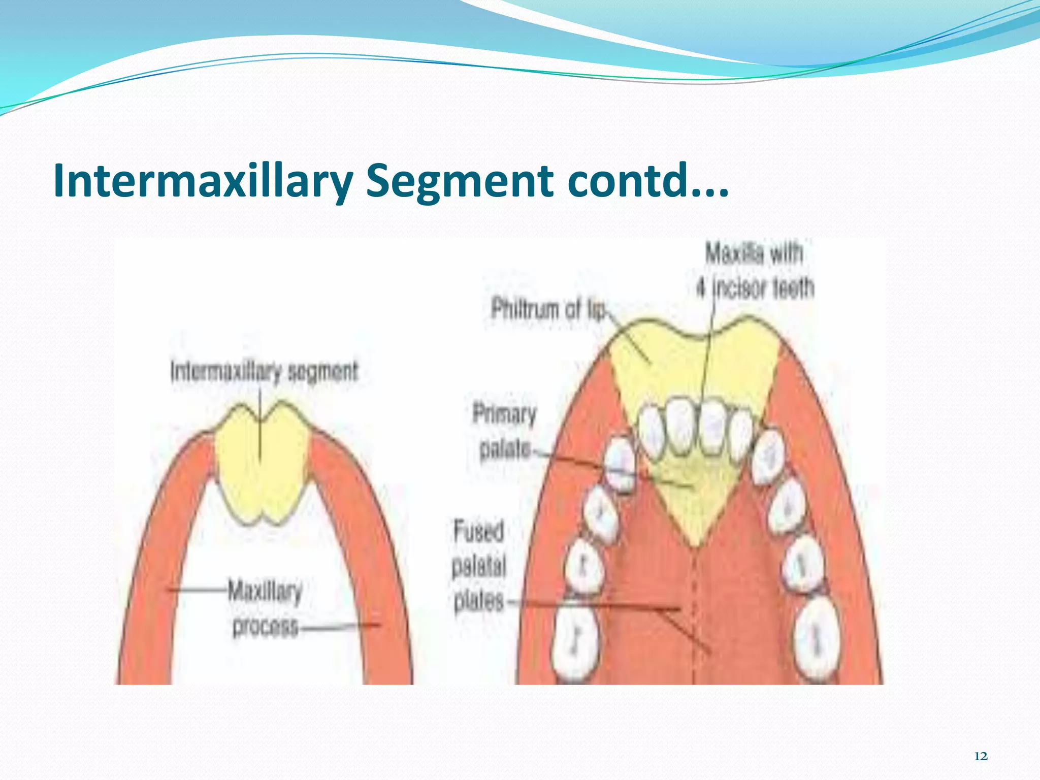 Intermaxillary Segment contd...




                                  12
 