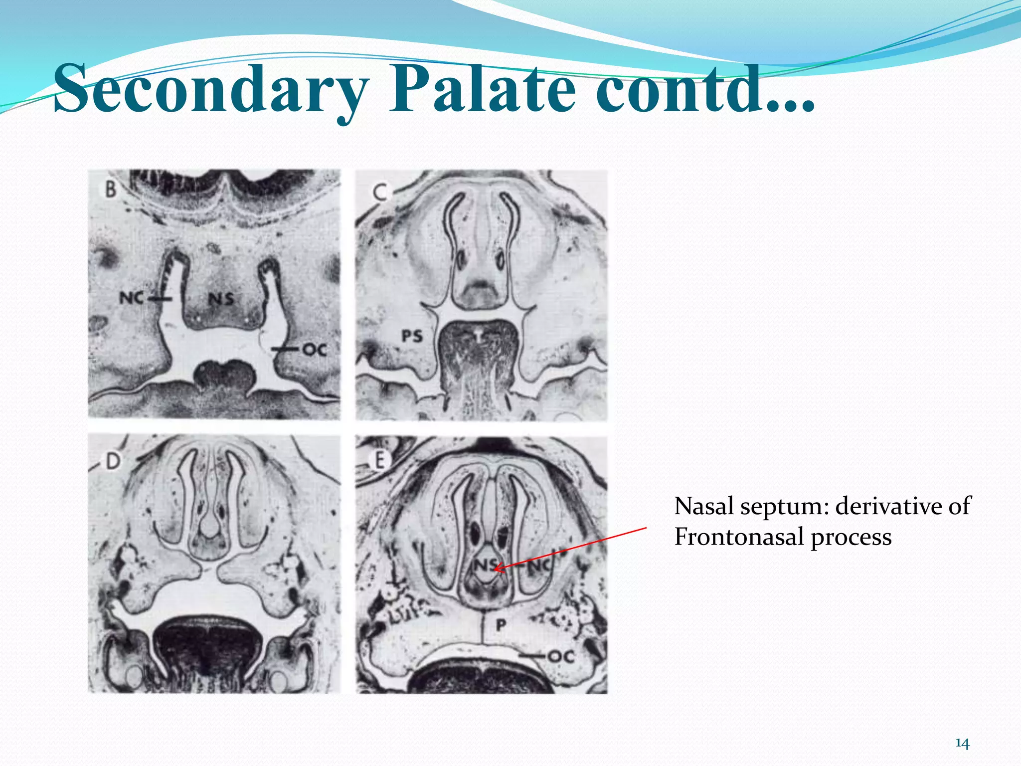 Secondary Palate contd...




                    Nasal septum: derivative of
                    Frontonasal process




                                             14
 