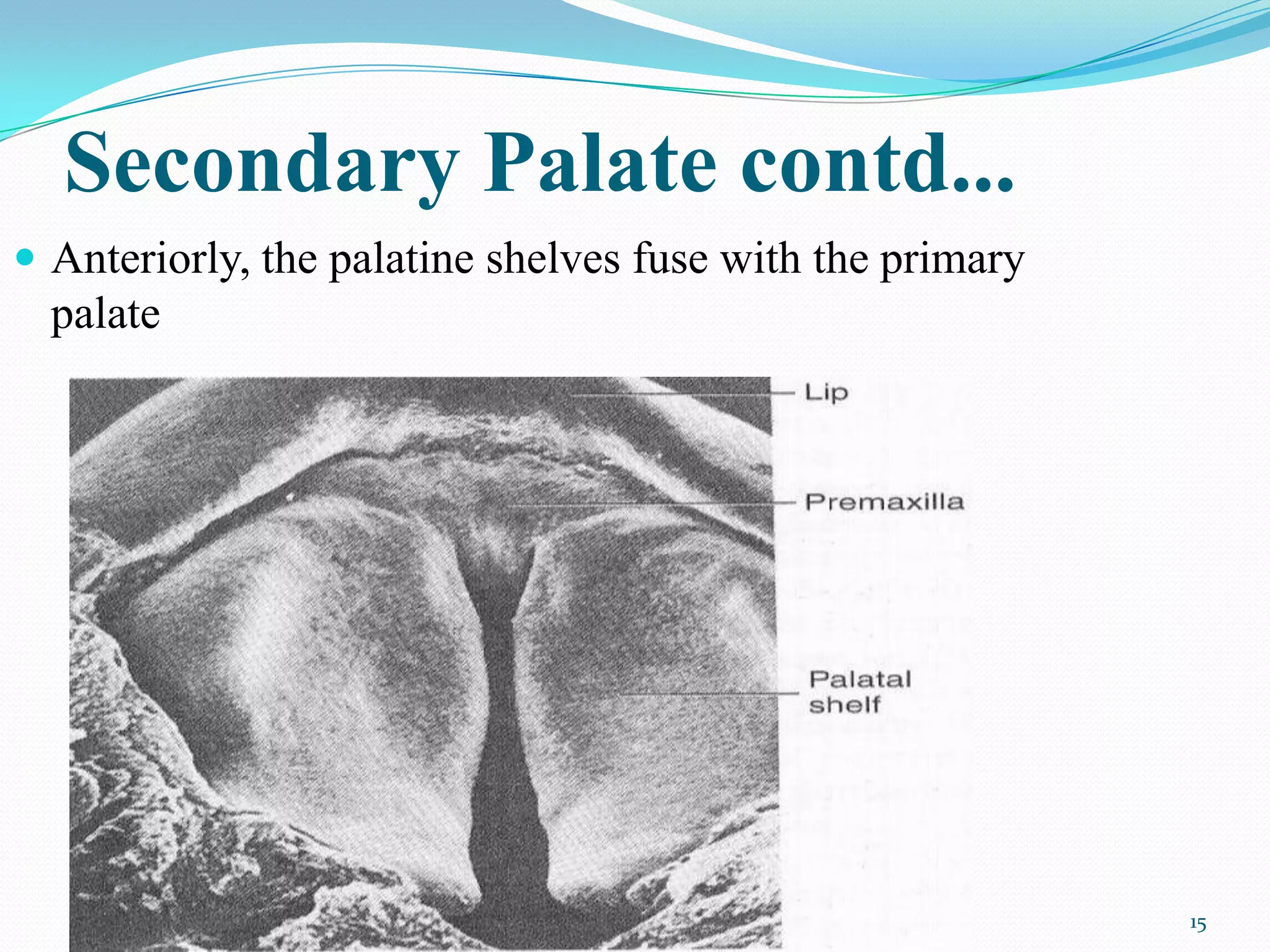 Secondary Palate contd...
 Anteriorly, the palatine shelves fuse with the primary
  palate




                                                           15
 