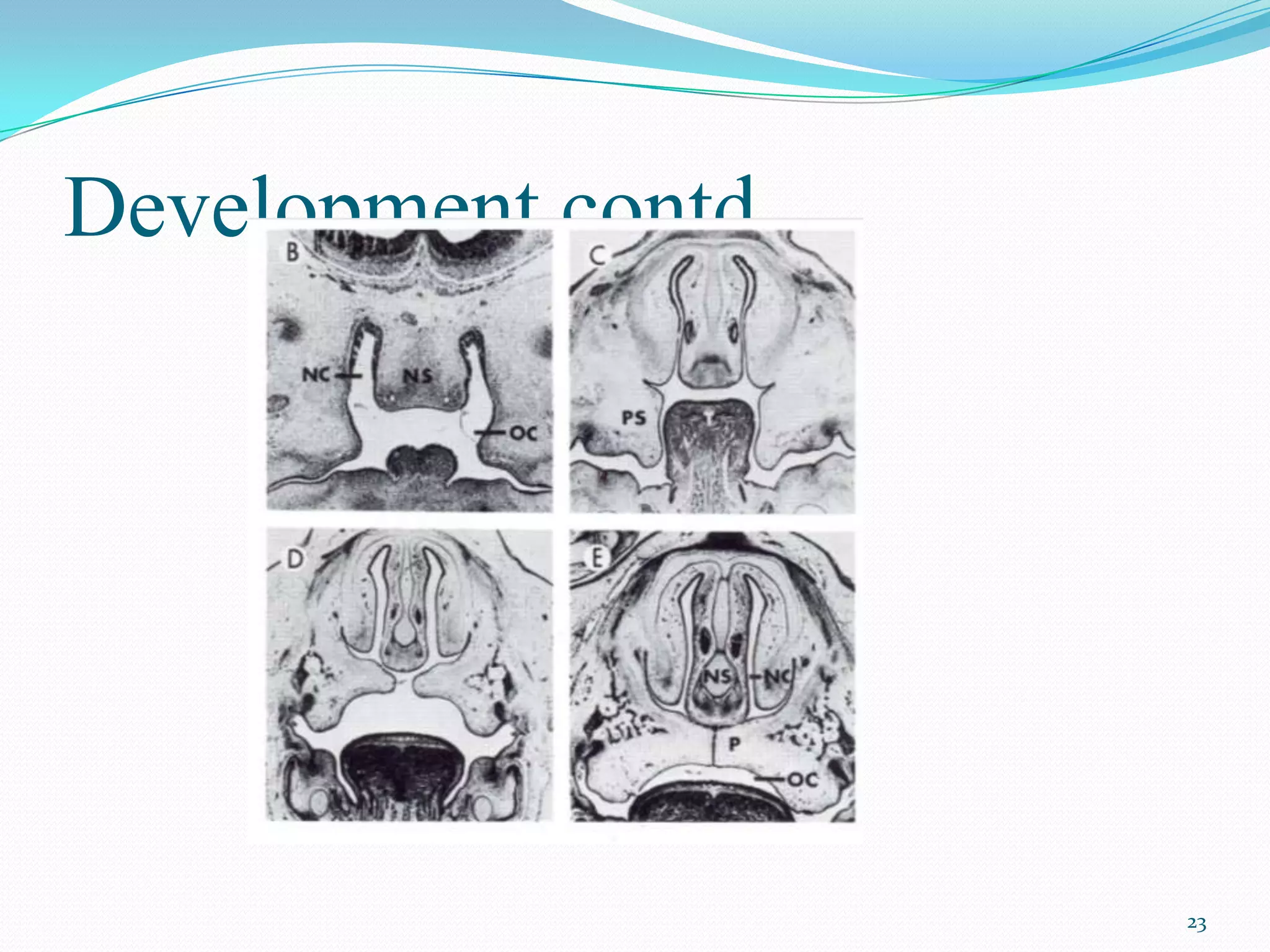 Development contd....




                        23
 