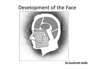 Development of the Face




                  Dr.Dashrath Kafle
 