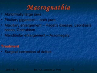 29/07/2017 BY - Dr. Sanjana G. Patil 103
Macrognathia
 Abnormally large jaws
 Pituitary gigantism – both jaws
 Maxillary enlargement – Paget’s disease, Leontiasis
ossea, Cherubism.
 Mandibular enlargement – Acromegaly.
Treatment
 Surgical correction of defect.
 