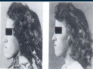 29/07/2017 BY - Dr. Sanjana G. Patil 104
 