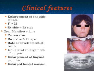 29/07/2017 BY - Dr. Sanjana G. Patil 107
Clinical features
 