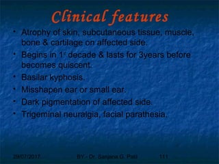 29/07/2017 BY - Dr. Sanjana G. Patil 111
Clinical features
 Atrophy of skin, subcutaneous tissue, muscle,
bone & cartilage on affected side.
 Begins in 1st
decade & lasts for 3years before
becomes quiscent.
 Basilar kyphosis.
 Misshapen ear or small ear.
 Dark pigmentation of affected side.
 Trigeminal neuralgia, facial parathesia.
 