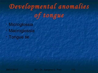29/07/2017 BY - Dr. Sanjana G. Patil 113
Developmental anomalies
of tongue
• Microglossia
• Macroglossia
• Tongue tie
 