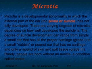 29/07/2017 BY - Dr. Sanjana G. Patil 119
Microtia
 Microtia is a developmental abnormality in which the
external part of the ear (the pinna or auricle) has not
fully developed. There are varying degrees of microtia
depending on how well developed the auricle is. The
degree of auricle development can range from simply
a small ear that has all the proper cartilage (grade I) to
a small "nubbin" or peanut ear that has no cartilage
and only a mound of skin and soft tissue (grade III).
Rarely, people are born without an auricle, a condition
called anotia.
 