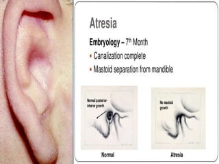 29/07/2017 BY - Dr. Sanjana G. Patil 122
 