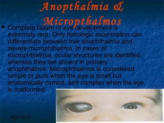 29/07/2017 BY - Dr. Sanjana G. Patil 125
Anopthalmia &
Micropthalmos Complete failure of eye development is
extremely rare. Only histologic examination can
differentiate between true anophthalmia and
severe microphthalmia. In cases of
microphthalmia, ocular structures are identified,
whereas they are absent in primary
anophthalmia. Microphthalmos is considered
simple or pure when the eye is small but
anatomically correct, and complex when the eye
is malformed
 