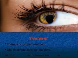 29/07/2017 BY - Dr. Sanjana G. Patil 129
Treatment
 There is no proper treatment .
 Use of contact lens can be done.
 