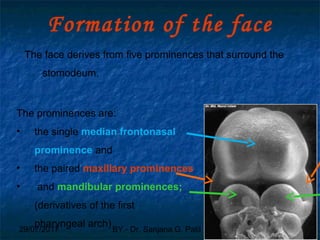 29/07/2017 BY - Dr. Sanjana G. Patil 19
Formation of the face
The face derives from five prominences that surround the
stomodeum.
The prominences are:
• the single median frontonasal
prominence and
• the paired maxillary prominences
• and mandibular prominences;
(derivatives of the ﬁrst
pharyngeal arch)
 