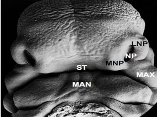 29/07/2017 BY - Dr. Sanjana G. Patil 23
 