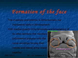 29/07/2017 BY - Dr. Sanjana G. Patil 25
Formation of the face
The maxillary prominence is dimensionally not
impressive early in development.
With medial growth of its terminals and broadening of
its other borders, the maxillary
prominence presses onto the
nasal swellings forcing their
medial and lateral arms closer
together.
 
