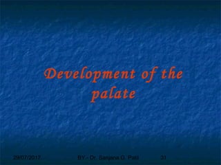 29/07/2017 BY - Dr. Sanjana G. Patil 31
Development of the
palate
 