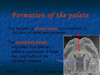 29/07/2017 BY - Dr. Sanjana G. Patil 32
Formation of the palate
The formation of primary palate is a contribution of
the fusion of medial nasal processes.
The secondary palate
originates from lateral
palatine processes, a ledge
like outgrowths of the
maxillary process
 