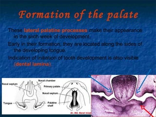 29/07/2017 BY - Dr. Sanjana G. Patil 33
Formation of the palate
These lateral palatine processes make their appearance
in the sixth week of development.
Early in their formation, they are located along the sides of
the developing tongue.
Indication of initiation of tooth development is also visible
(dental lamina).
 
