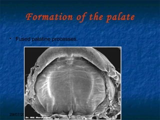 29/07/2017 BY - Dr. Sanjana G. Patil 37
Formation of the palate
 Fused palatine processes.
 