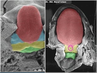 29/07/2017 BY - Dr. Sanjana G. Patil 44
 