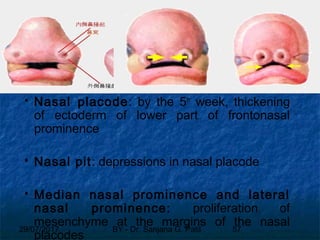 29/07/2017 BY - Dr. Sanjana G. Patil 57
 Nasal placode: by the 5th
week, thickening
of ectoderm of lower part of frontonasal
prominence
 Nasal pit: depressions in nasal placode
 Median nasal prominence and lateral
nasal prominence: proliferation of
mesenchyme at the margins of the nasal
placodes
 