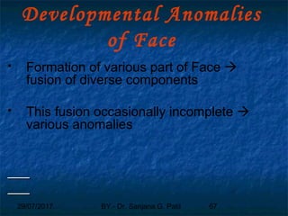29/07/2017 BY - Dr. Sanjana G. Patil 67
Developmental Anomalies
of Face
 Formation of various part of Face 
fusion of diverse components
 This fusion occasionally incomplete 
various anomalies
 Formation of various part of Face 
fusion of diverse components
 This fusion occasionally incomplete 
various anomalies
 
