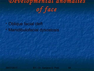 29/07/2017 BY - Dr. Sanjana G. Patil 68
Developmental anomalies
of face
 Oblique facial cleft
 Manidibulofacial dysostosis
 