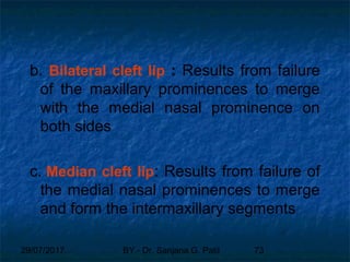 29/07/2017 BY - Dr. Sanjana G. Patil 73
b. Bilateral cleft lip : Results from failure
of the maxillary prominences to merge
with the medial nasal prominence on
both sides
c. Median cleft lip: Results from failure of
the medial nasal prominences to merge
and form the intermaxillary segments
 