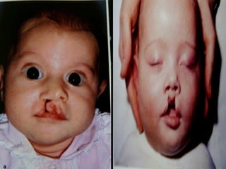 29/07/2017 BY - Dr. Sanjana G. Patil 74
 