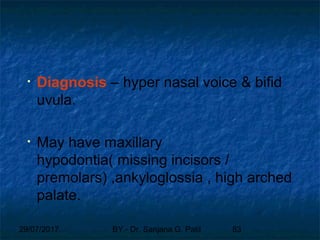 29/07/2017 BY - Dr. Sanjana G. Patil 83
• Diagnosis – hyper nasal voice & bifid
uvula.
• May have maxillary
hypodontia( missing incisors /
premolars) ,ankyloglossia , high arched
palate.
 