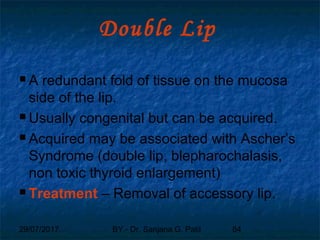 29/07/2017 BY - Dr. Sanjana G. Patil 84
Double Lip
 A redundant fold of tissue on the mucosa
side of the lip.
 Usually congenital but can be acquired.
 Acquired may be associated with Ascher’s
Syndrome (double lip, blepharochalasis,
non toxic thyroid enlargement)
 Treatment – Removal of accessory lip.
 