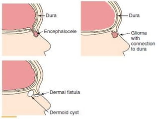 29/07/2017 BY - Dr. Sanjana G. Patil 87
 