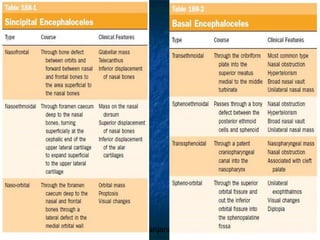 29/07/2017 BY - Dr. Sanjana G. Patil 90
 