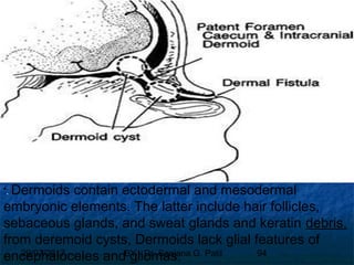 29/07/2017 BY - Dr. Sanjana G. Patil 94

. Dermoids contain ectodermal and mesodermal
embryonic elements. The latter include hair follicles,
sebaceous glands, and sweat glands and keratin debris.
from deremoid cysts, Dermoids lack glial features of
encephaloceles and gliomas.
 
