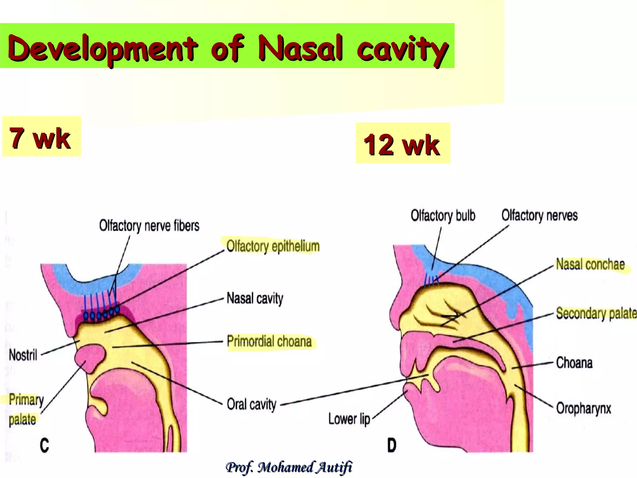 Development of Nasal cavity
7 wk

12 wk

Prof. Mohamed Autifi

 