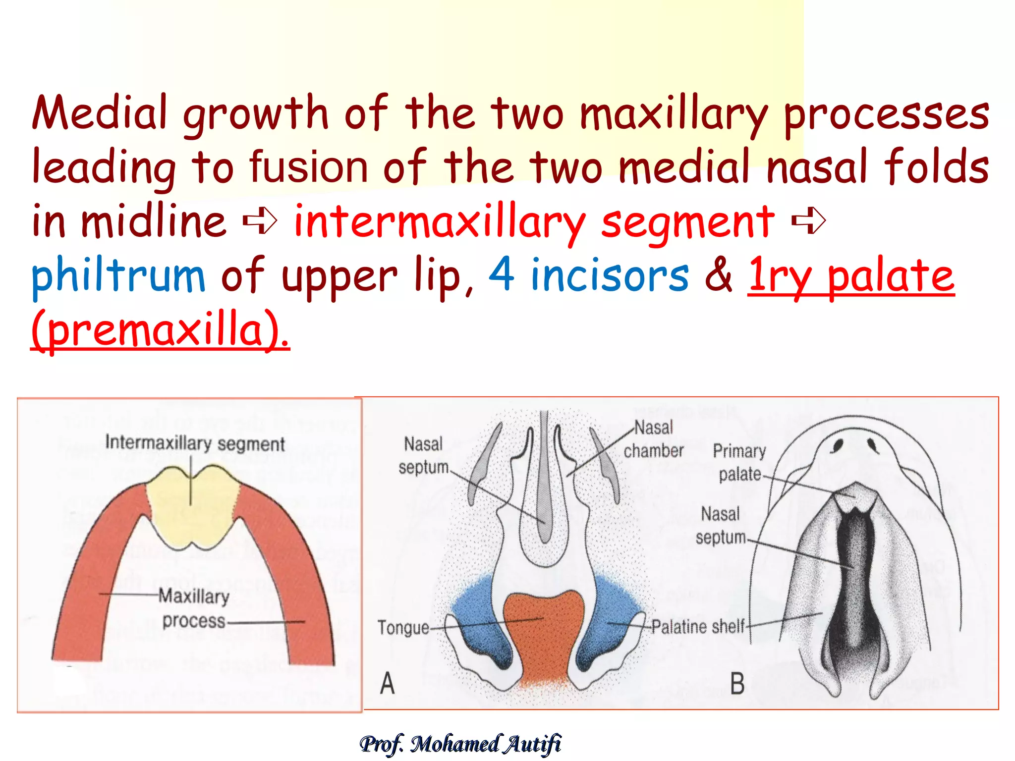Medial growth of the two maxillary processes
leading to fusion of the two medial nasal folds
in midline ➪ intermaxillary segment ➪
philtrum of upper lip, 4 incisors & 1ry palate
(premaxilla).

Prof. Mohamed Autifi

 