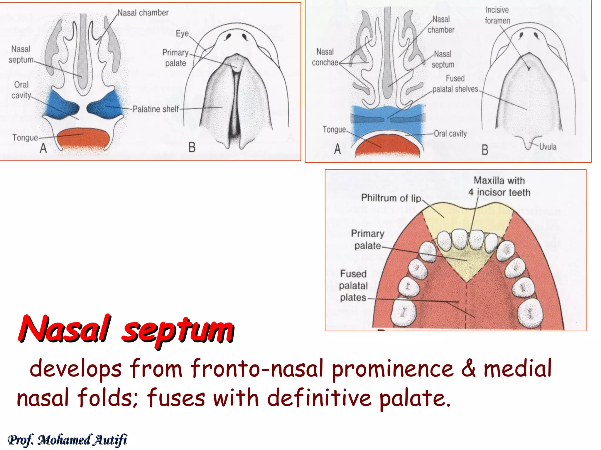 Nasal septum

develops from fronto-nasal prominence & medial
nasal folds; fuses with definitive palate.
Prof. Mohamed Autifi

 