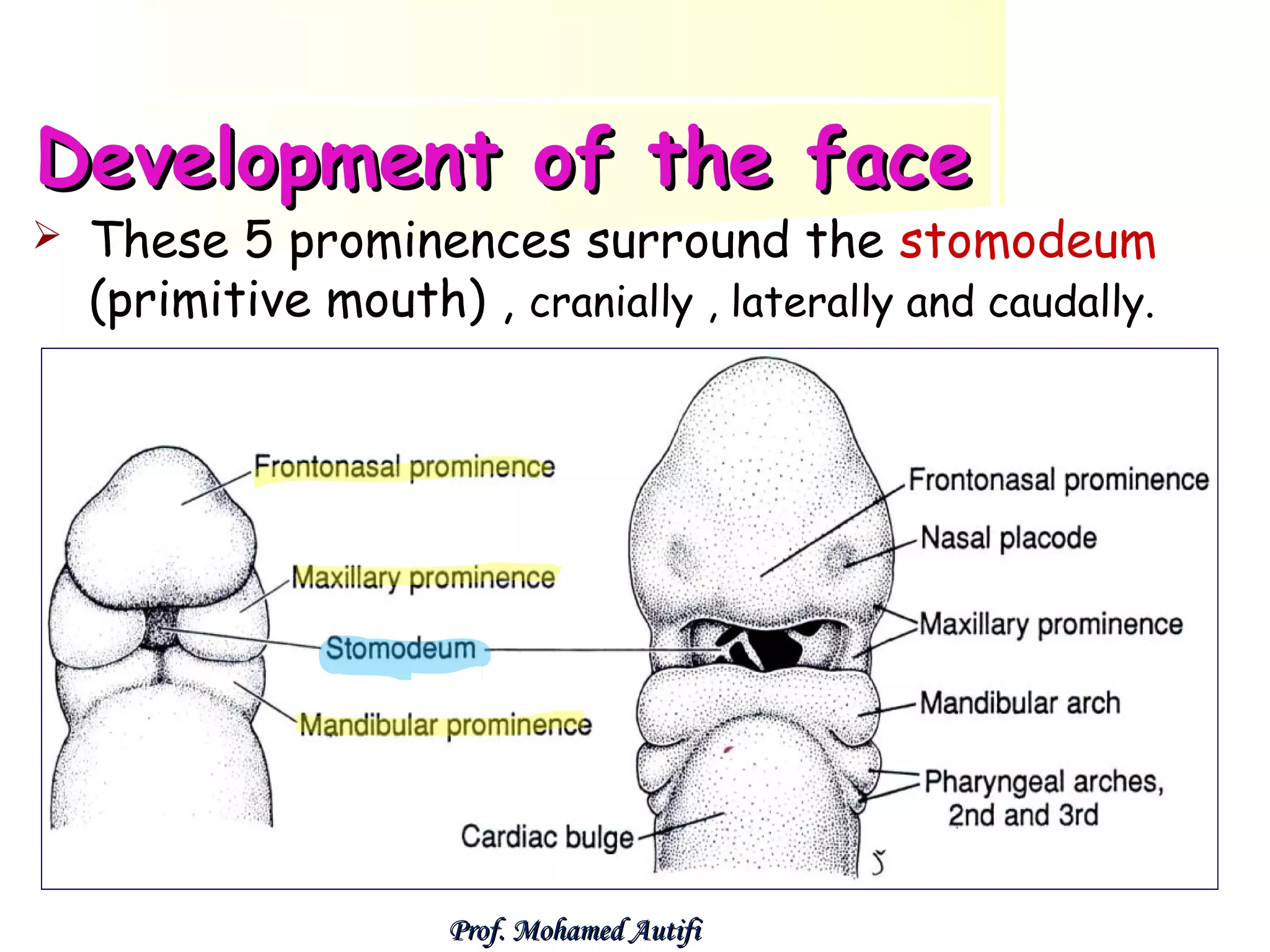 Development of the face


These 5 prominences surround the stomodeum
(primitive mouth) , cranially , laterally and caudally.

Prof. Mohamed Autifi

 