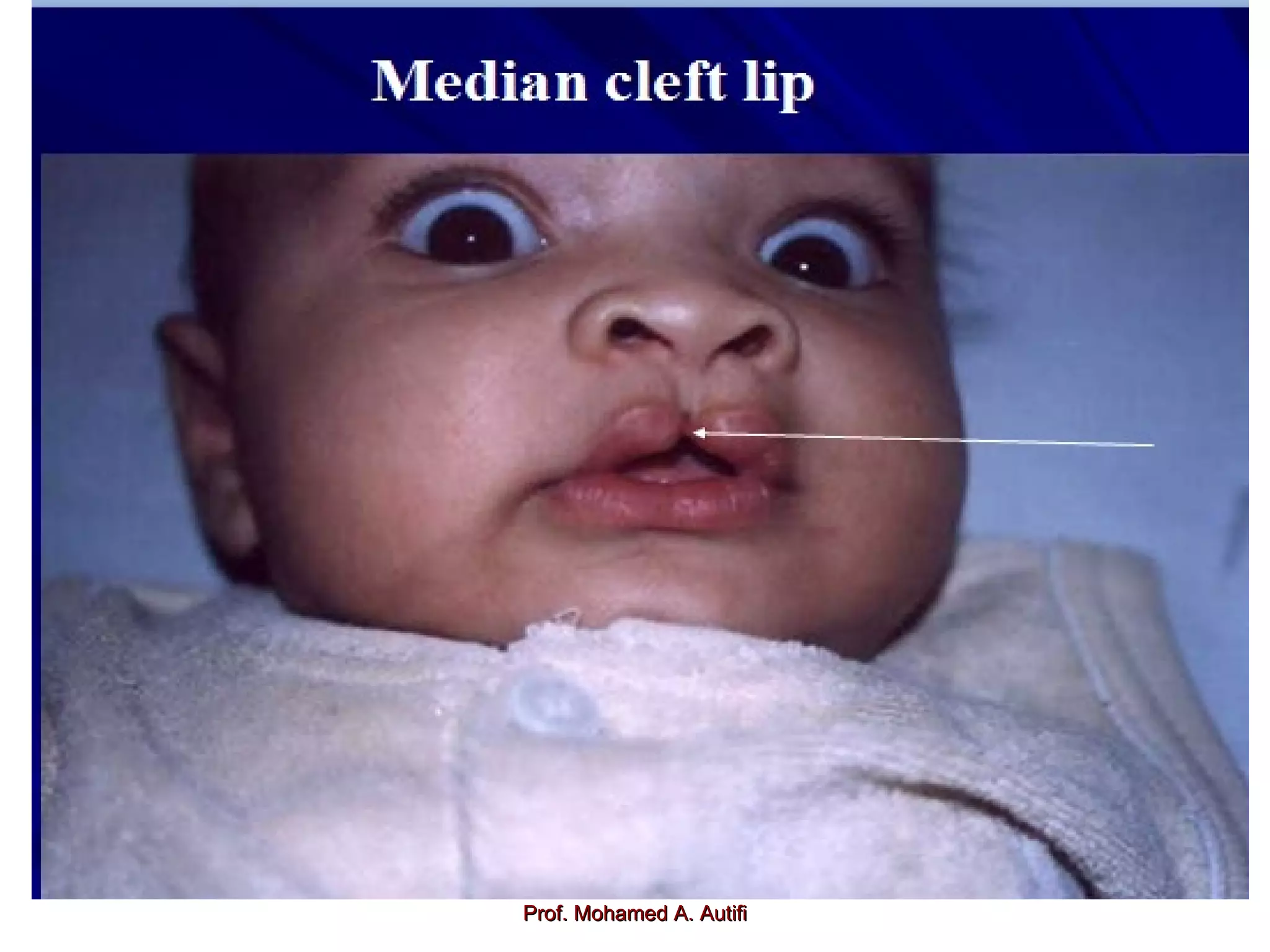 Prof. Mohamed A. Autifi

 